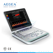 AG-BU005 Sistema de ultrasonido Doppler de color para notebooks avanzado y conveniente para el hospital